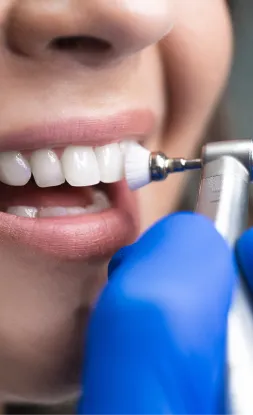 Dental Cleanings